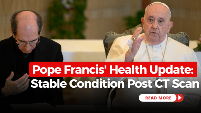 Pope Francis' Health Update: Stable Condition Post CT Scan Pope francis health conditions
