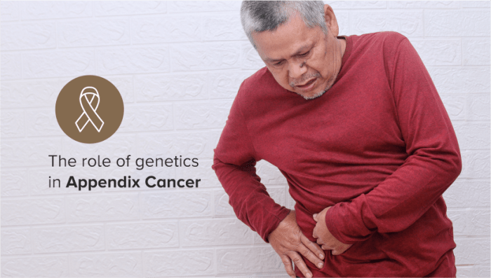 Understanding the Genetic Role in Appendix Cancer | AOI Appendix cancer rising millennials